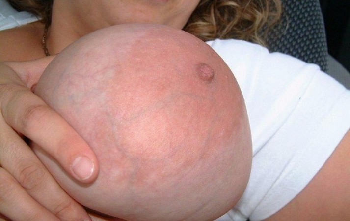 pregnant tits